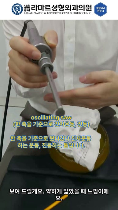 성형수술의 끝판! 성형외과 윤곽수술을 알려드립니다. 저희병원에서 사용하는 수술기구, 그리고 윤곽3종 모의수술....!! 관련 이미지 60