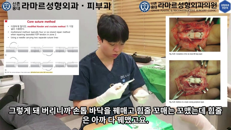 손가락 힘줄 손상 및 열상, 손톱 바닥 열상 처치 (Extensor tendon repair and nailbed injury treatment) 관련 이미지 15