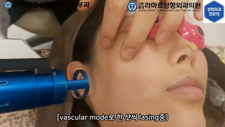 우리병원 토닝레이저 실제 시술과정 보여드립니다. 관련 이미지 33
