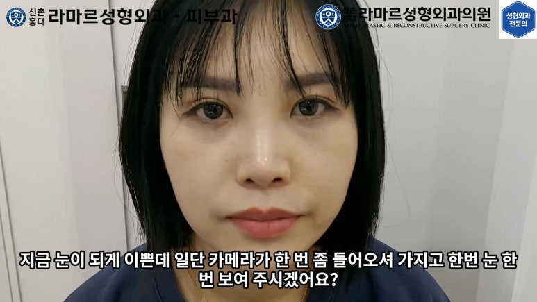 30대 여성 "쌍꺼풀+눈매교정" 상담, 디자인, 수술 전체 과정, 결과, 경과 모두 공개합니다. 관련 이미지 50