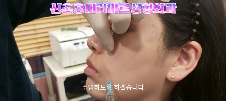 30대 여성 팔자필러 시술: 팔자주름과 안전이별 하는 법 관련 이미지 7