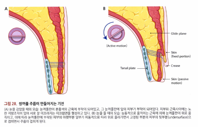 38세 서양 백인 여성, 쌍꺼풀 수술과 눈매교정 및 하안검성형술 (38/F Upper&lower blepharoplasty with levator plication) 관련 이미지 20