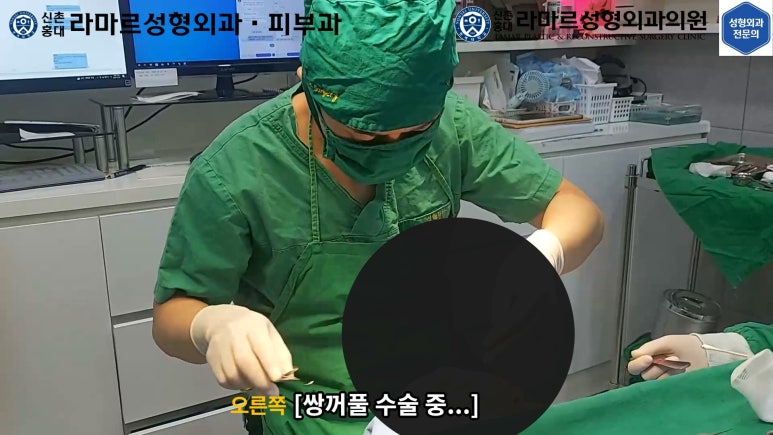 30대 여성 "쌍꺼풀+눈매교정" 상담, 디자인, 수술 전체 과정, 결과, 경과 모두 공개합니다. 관련 이미지 27
