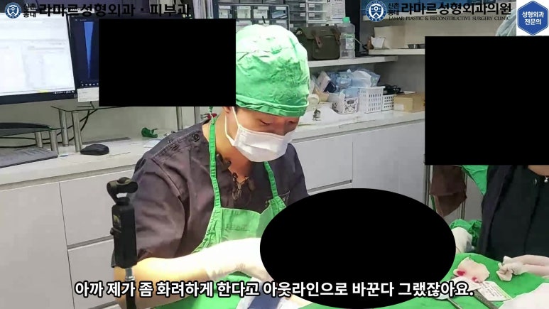 매몰 쌍꺼풀 풀고 절개쌍꺼풀로 바꾸는 쌍꺼풀 재수술!! 관련 이미지 30