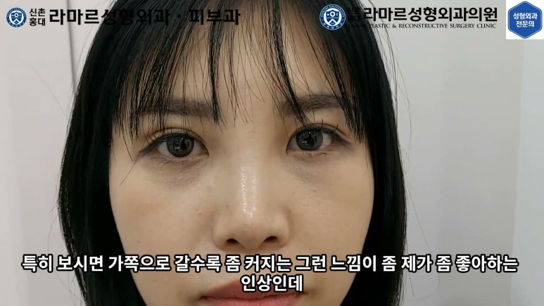 30대 여성 "쌍꺼풀+눈매교정" 상담, 디자인, 수술 전체 과정, 결과, 경과 모두 공개합니다. 관련 이미지 51