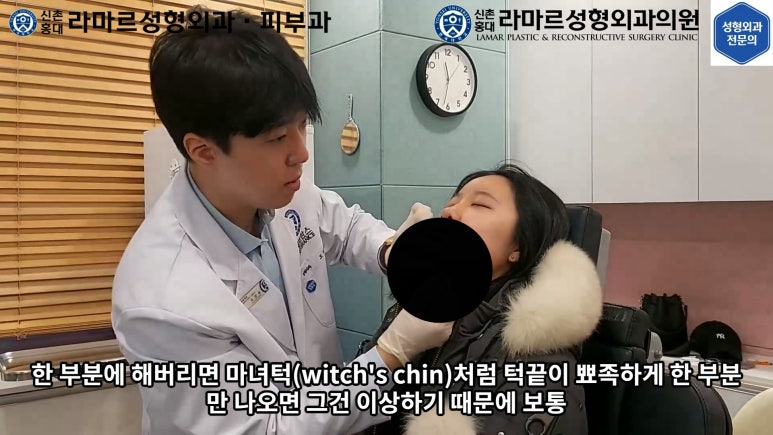 지름 1cm 코 점 제거수술 : 나선피판술(Spiral Flap) 수술전~1달 경과. (Feat. 턱끝필러+사각턱 보톡스) 관련 이미지 101