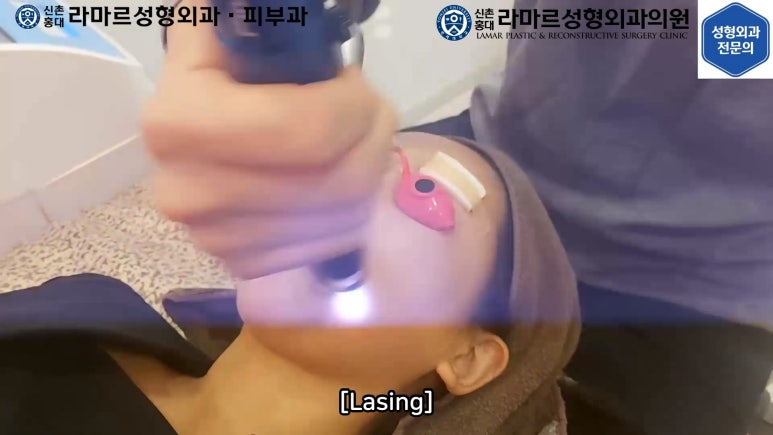 우리병원 토닝레이저 실제 시술과정 보여드립니다. 관련 이미지 32