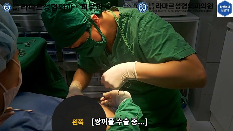 30대 여성 "쌍꺼풀+눈매교정" 상담, 디자인, 수술 전체 과정, 결과, 경과 모두 공개합니다. 관련 이미지 29