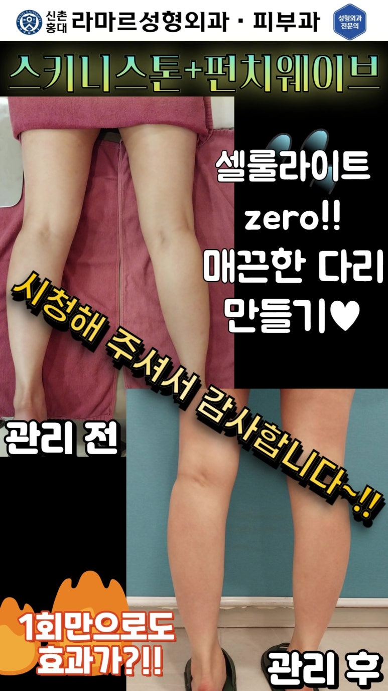 [체형레이저] 얇고 매끈한 다리, 팔, 허리만들기~!! 관련 이미지 84