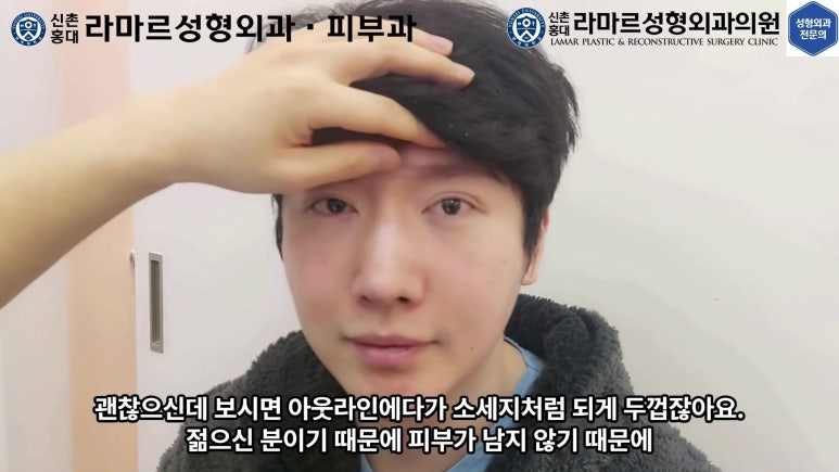 29세 남자, 소시지 쌍꺼풀 두줄따기로 낮추기 (쌍꺼풀 재수술) 관련 이미지 9