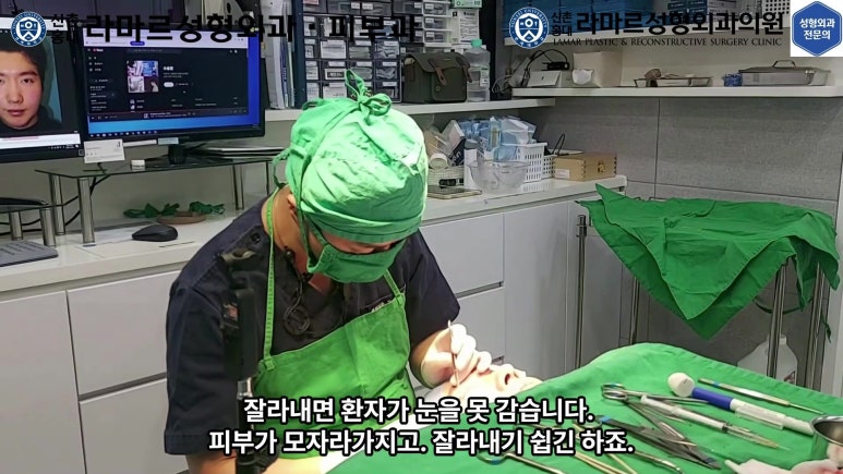 29세 남자, 소시지 쌍꺼풀 두줄따기로 낮추기 (쌍꺼풀 재수술) 관련 이미지 47