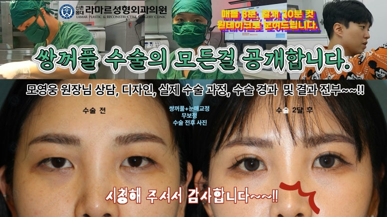 30대 여성 "쌍꺼풀+눈매교정" 상담, 디자인, 수술 전체 과정, 결과, 경과 모두 공개합니다. 관련 이미지 94