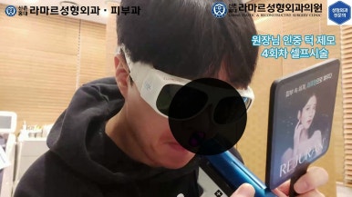 [성형외과 전문의의 셀프시술 제8편] 인중, 아래턱 제모 4회차 결과 공개! 관련 이미지 110