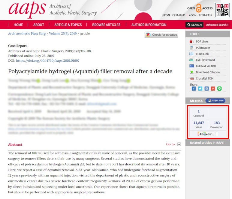 AAPS-Polyacrylamide hydrogel (Aquamid) filler removal after a decade 관련 이미지 2