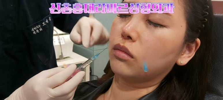 30대 여성 팔자필러 시술: 팔자주름과 안전이별 하는 법 관련 이미지 4
