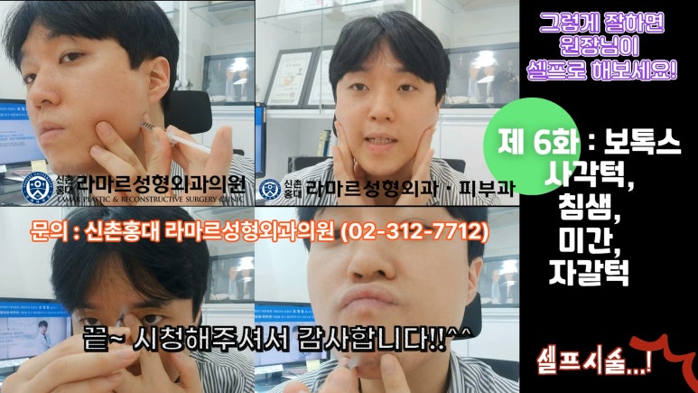 모영웅 대표원장 셀프시술 제6편! 사각턱, 침샘, 미간, 자갈턱 보톡스~! 전체 시술과정 공개합니다 관련 이미지 38