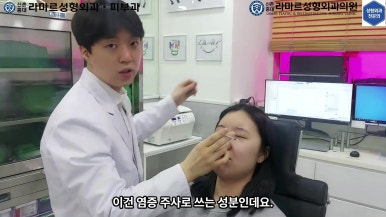 21세 여성 코 지름 1cm 점 제거수술 : 나선피판술(Spiral Flap) 수술전~5달 경과. (+쌍꺼풀수술, 코필러) 관련 이미지 32