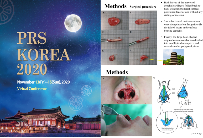 2022년 7월 25일 처음으로 블로그를 시작하며... 관련 이미지 24