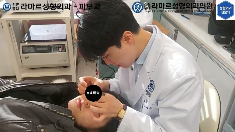 지름 1cm 코 점 제거수술 : 나선피판술(Spiral Flap) 수술전~1달 경과. (Feat. 턱끝필러+사각턱 보톡스) 관련 이미지 66