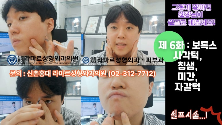 모영웅 대표원장 셀프시술 제6편! 사각턱, 침샘, 미간, 자갈턱 보톡스~! 전체 시술과정 공개합니다 관련 이미지 5