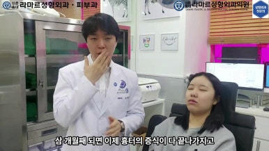 21세 여성 코 지름 1cm 점 제거수술 : 나선피판술(Spiral Flap) 수술전~5달 경과. (+쌍꺼풀수술, 코필러) 관련 이미지 12