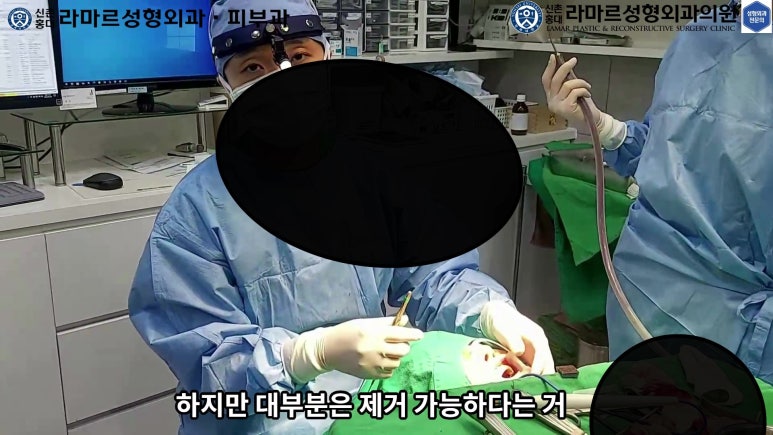 파라핀 필러 입 안 절개로 흉터없이 빼내기! 관련 이미지 79
