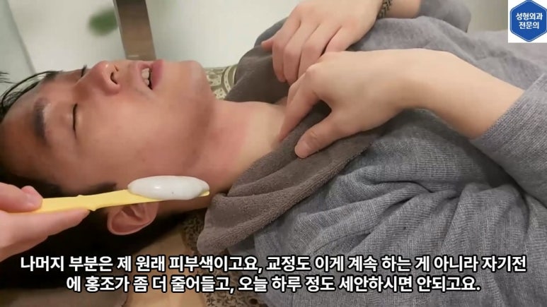 모영웅 대표원장 해초필링(FCR peeling) 피부관리영상...! 멍게피부가 사과피부가 되는 과정을 보여드립니다^^ 관련 이미지 36