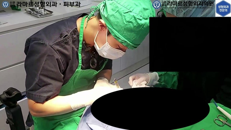 매몰 쌍꺼풀 풀고 절개쌍꺼풀로 바꾸는 쌍꺼풀 재수술!! 관련 이미지 19
