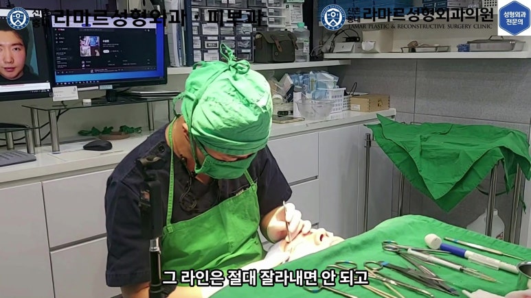 29세 남자, 소시지 쌍꺼풀 두줄따기로 낮추기 (쌍꺼풀 재수술) 관련 이미지 46