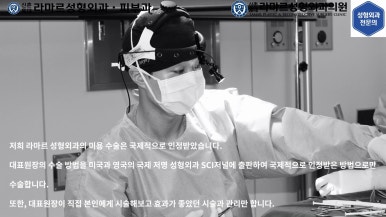 [성형외과 전문의의 셀프시술 제9편] 인중, 아래턱 제모 5,6회차 결과 공개! 관련 이미지 94