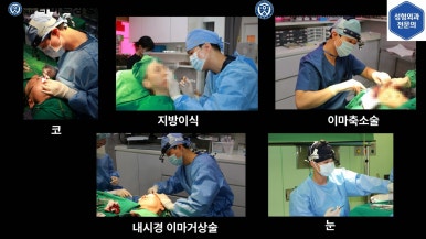 [성형외과 전문의의 셀프시술 제8편] 인중, 아래턱 제모 4회차 결과 공개! 관련 이미지 24