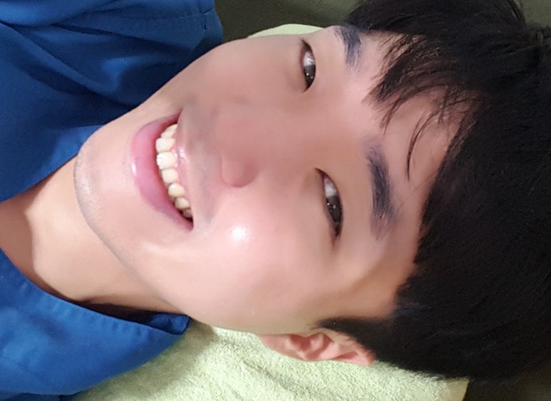 모영웅 대표원장 해초필링(FCR peeling) 피부관리영상...! 멍게피부가 사과피부가 되는 과정을 보여드립니다^^ 관련 이미지 45