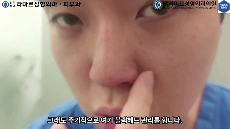 저의 코 모공, 블랙헤드 관리 실제 영상 및 후기~! 관련 이미지 9