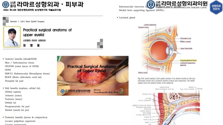 이대역 성형외과 개원의 퇴근 후 V-log 제 8편 : 눈성형연구회 학술심포지엄 발표 (눈성형연구회 학술위원) 관련 이미지 21