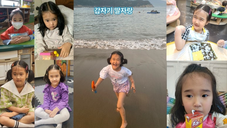 [모영웅 대표원장님 셀프시술 제7편] 인중, 아래턱 제모 시술과정 공개! 관련 이미지 41