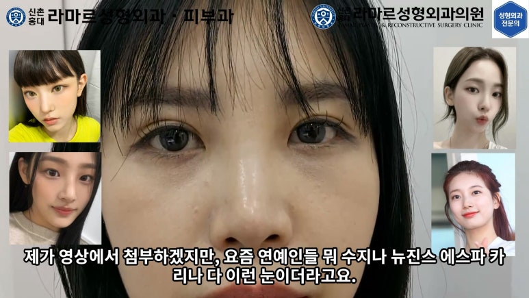 30대 여성 "쌍꺼풀+눈매교정" 상담, 디자인, 수술 전체 과정, 결과, 경과 모두 공개합니다. 관련 이미지 52