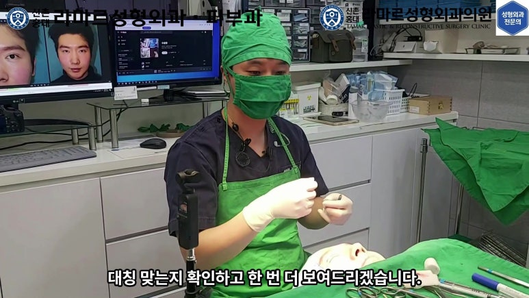 29세 남자, 소시지 쌍꺼풀 두줄따기로 낮추기 (쌍꺼풀 재수술) 관련 이미지 56