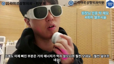 [성형외과 전문의의 셀프시술 제8편] 인중, 아래턱 제모 4회차 결과 공개! 관련 이미지 106