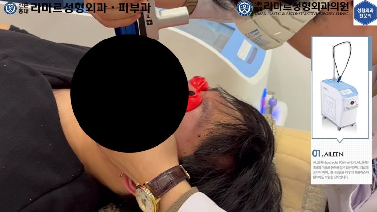 개에 물려 입술 1/3이 뜯긴 19세 남자분 치료 및 흉터 성형수술& 레이저 후기....! 관련 이미지 64