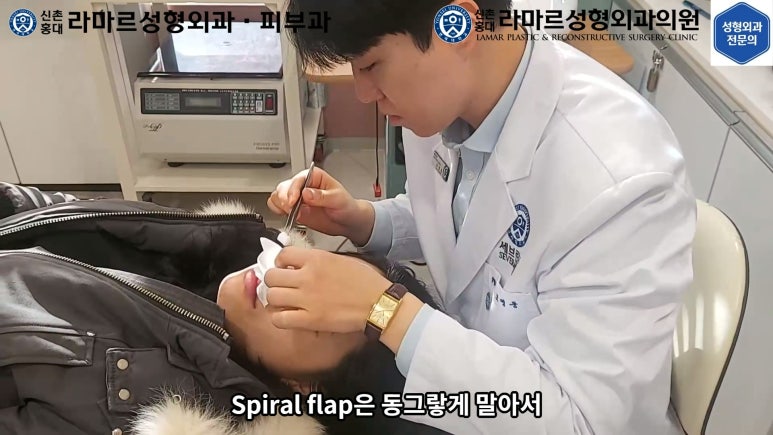 지름 1cm 코 점 제거수술 : 나선피판술(Spiral Flap) 수술전~1달 경과. (Feat. 턱끝필러+사각턱 보톡스) 관련 이미지 67