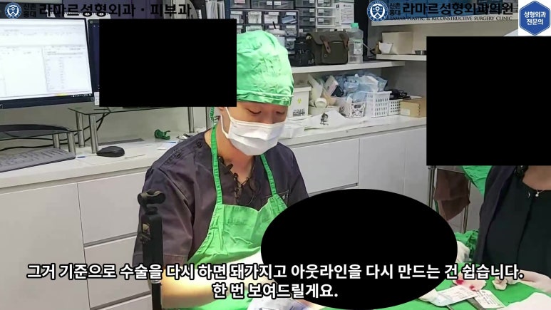 매몰 쌍꺼풀 풀고 절개쌍꺼풀로 바꾸는 쌍꺼풀 재수술!! 관련 이미지 33