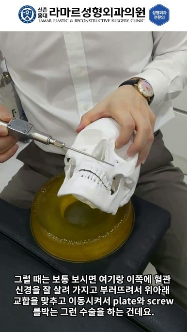 성형수술의 끝판! 성형외과 윤곽수술을 알려드립니다. 저희병원에서 사용하는 수술기구, 그리고 윤곽3종 모의수술....!! 관련 이미지 37
