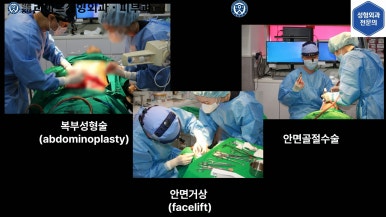 [성형외과 전문의의 셀프시술 제8편] 인중, 아래턱 제모 4회차 결과 공개! 관련 이미지 26