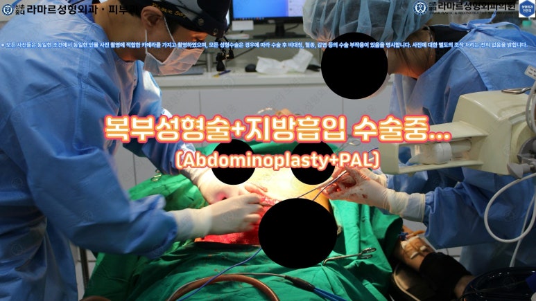 '복부성형술+지방흡입(Abdominoplasty+PAL)' 으로 뱃살 끝장내기! 관련 이미지 37