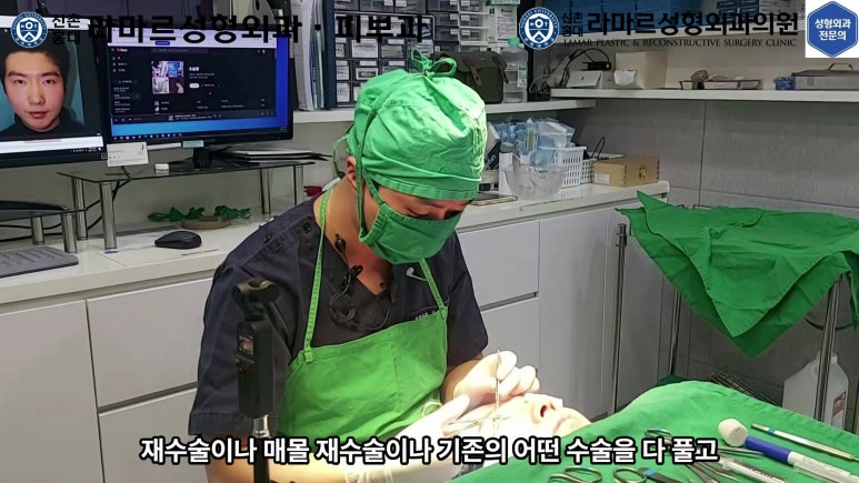 29세 남자, 소시지 쌍꺼풀 두줄따기로 낮추기 (쌍꺼풀 재수술) 관련 이미지 41