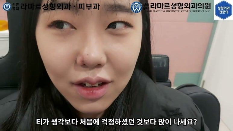 지름 1cm 코 점 제거수술 : 나선피판술(Spiral Flap) 수술전~1달 경과. (Feat. 턱끝필러+사각턱 보톡스) 관련 이미지 162