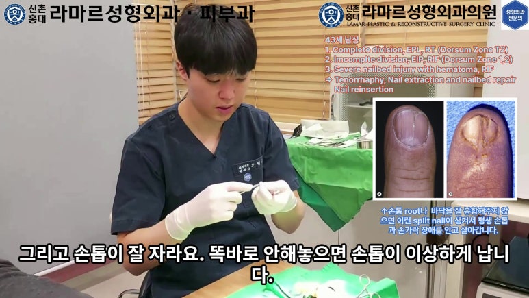 손가락 힘줄 손상 및 열상, 손톱 바닥 열상 처치 (Extensor tendon repair and nailbed injury treatment) 관련 이미지 24