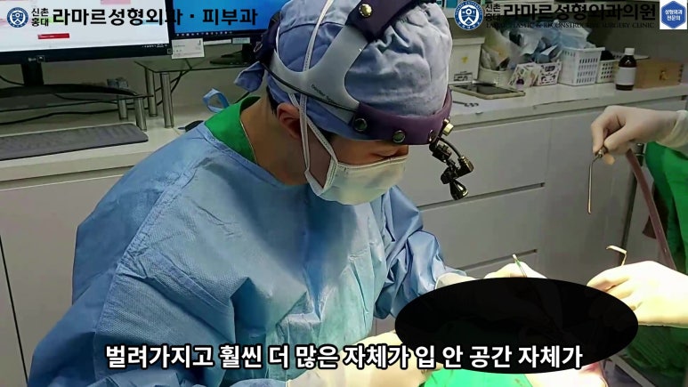 파라핀 필러 입 안 절개로 흉터없이 빼내기! 관련 이미지 40