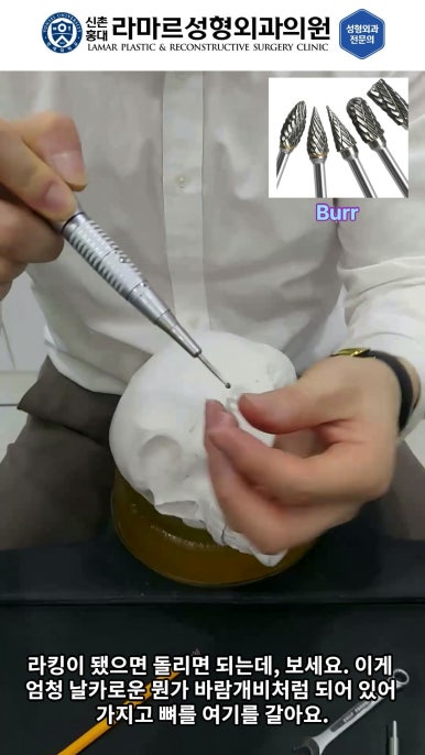 성형수술의 끝판! 성형외과 윤곽수술을 알려드립니다. 저희병원에서 사용하는 수술기구, 그리고 윤곽3종 모의수술....!! 관련 이미지 63