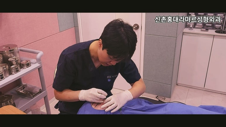 31세 여성 최소침습 하이코 코끝성형 관련 이미지 7